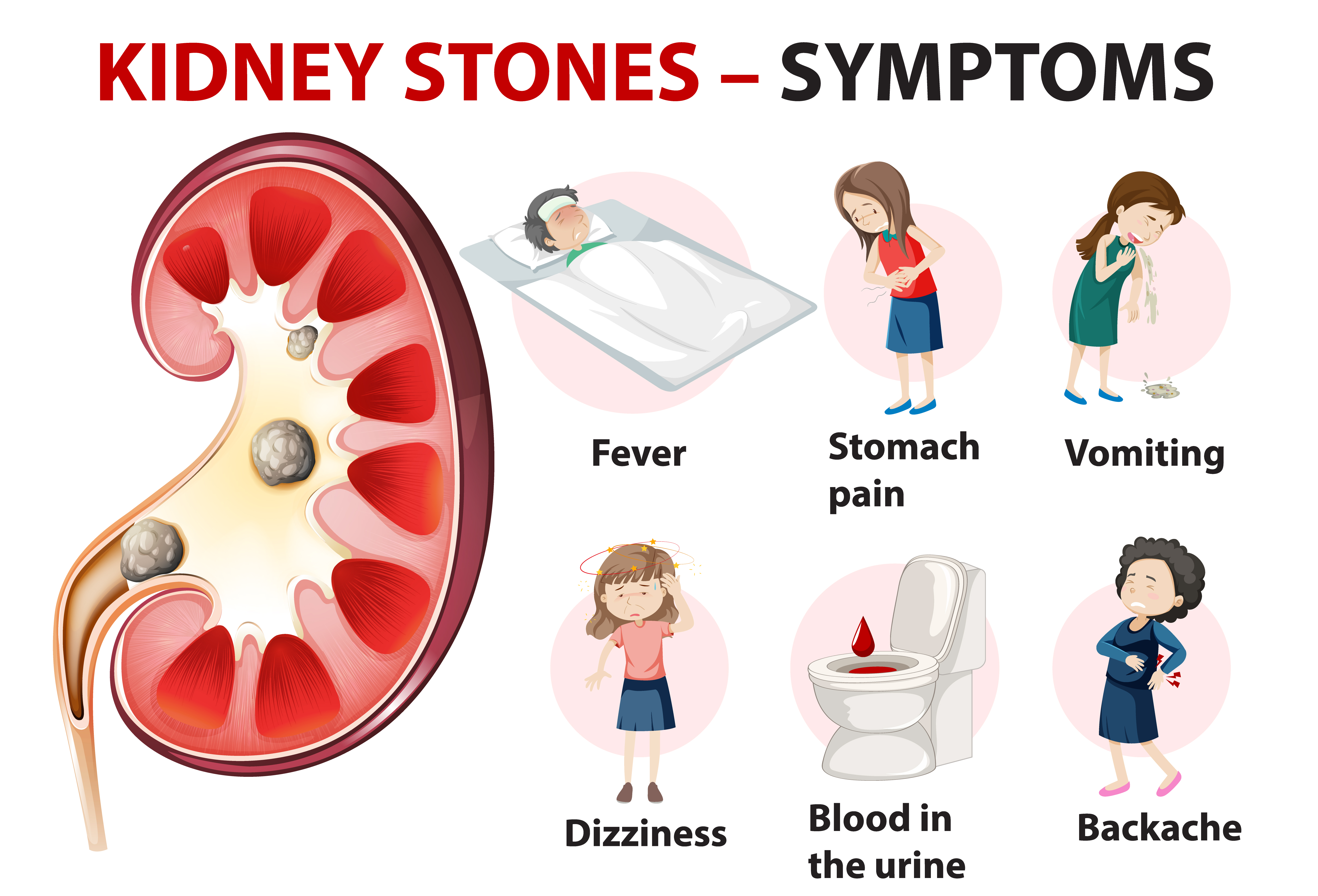 Best Hospital for Kidney Stone in Mulund