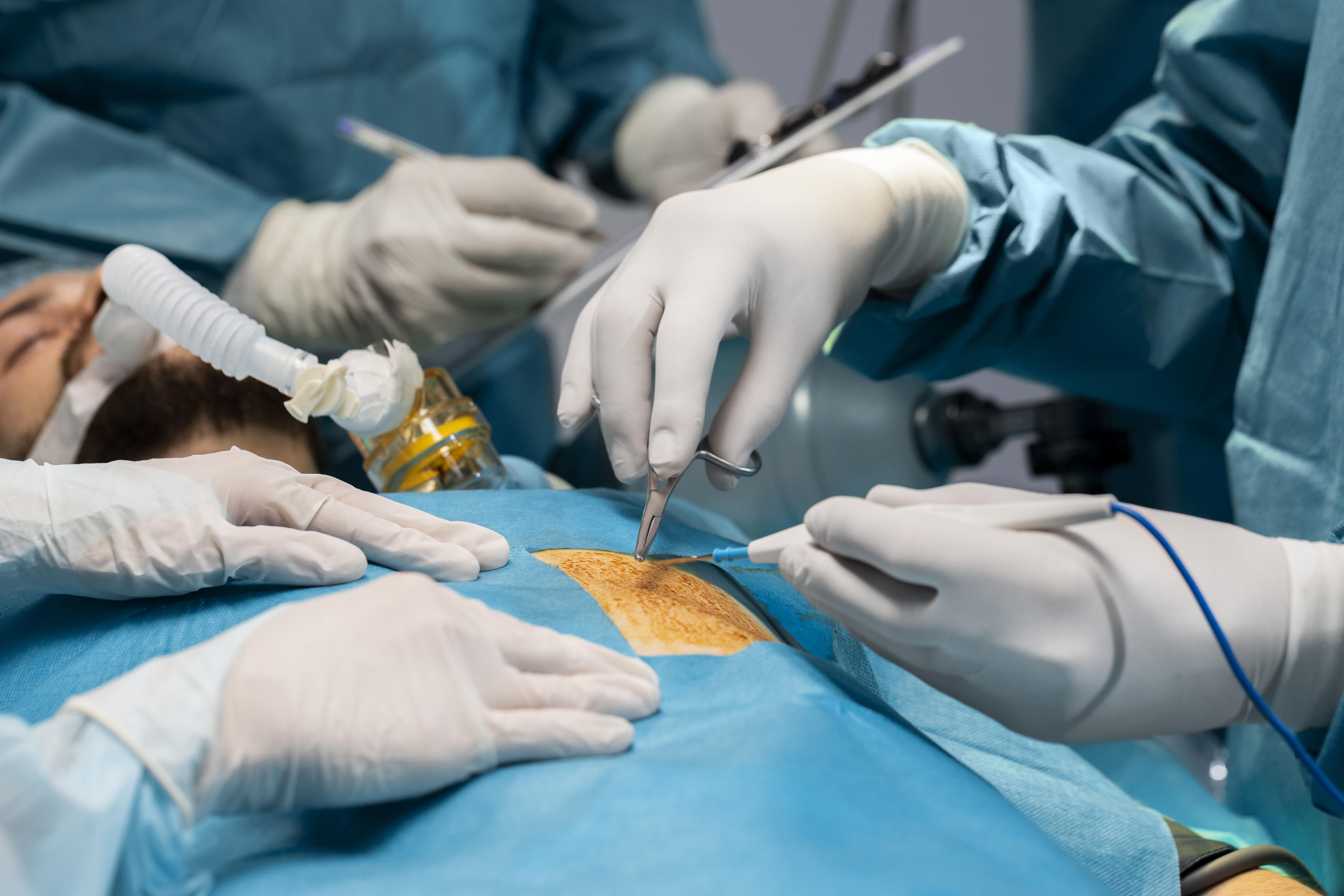 laparoscopic surgery treatment in Mulund
