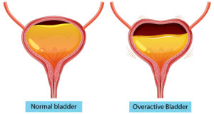 Urinary Tract Infection Treatment in Matunga 